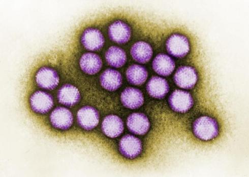 un-nuovo-sintomo-dellinfluenza1