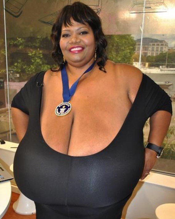 Norma Stitz, la donna con il seno più grande del mondo. La conoscevate?