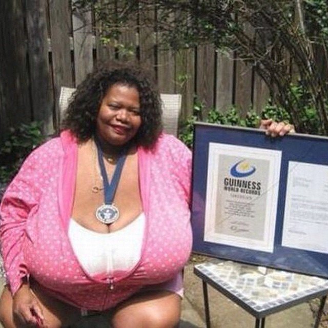 Norma Stitz, la donna con il seno più grande del mondo