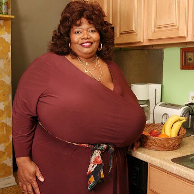 Norma Stitz, la donna con il seno più grande del mondo. La conoscevate?