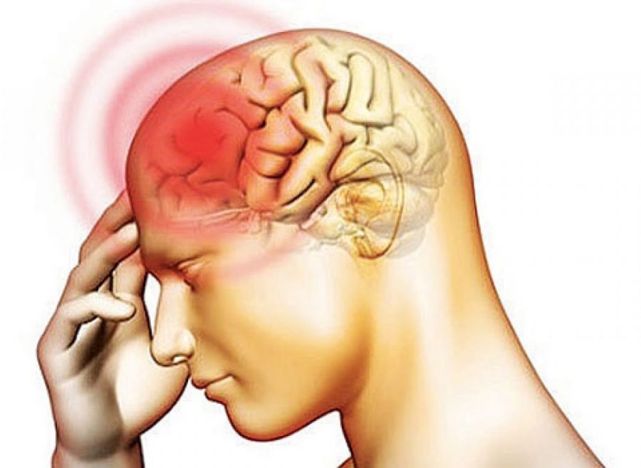 Meningite