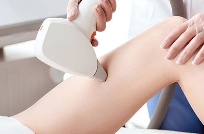 Depilazione laser pro e contro: tutto quello che devi sapere