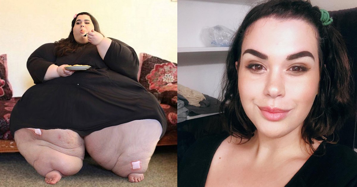 Pesava 300 chili e ora è una splendida ragazza: la storia di Amber
