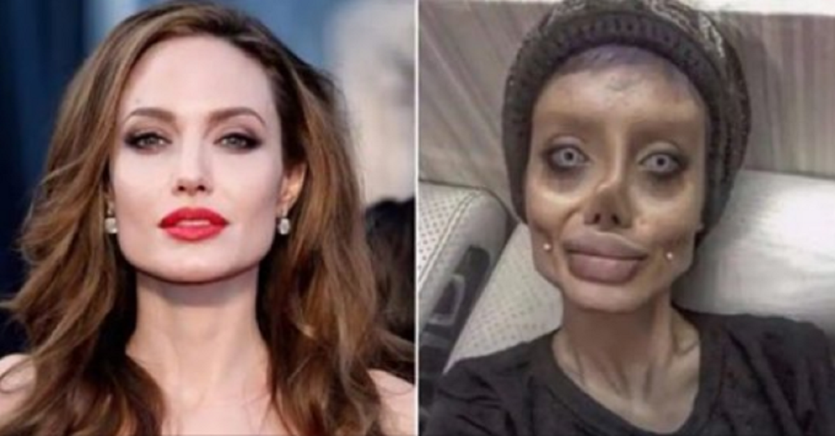 La “Angelina Jolie Iraniana” scuote il mondo con una nuova immagine dal letto d’ospedale