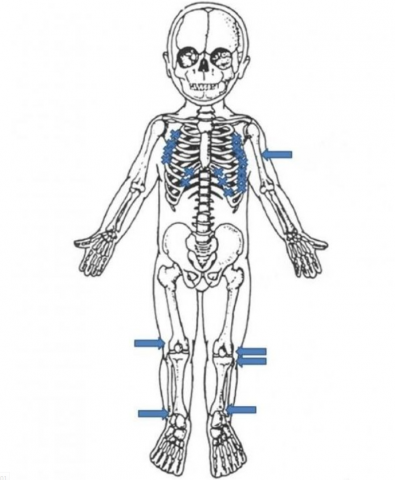 radiografia