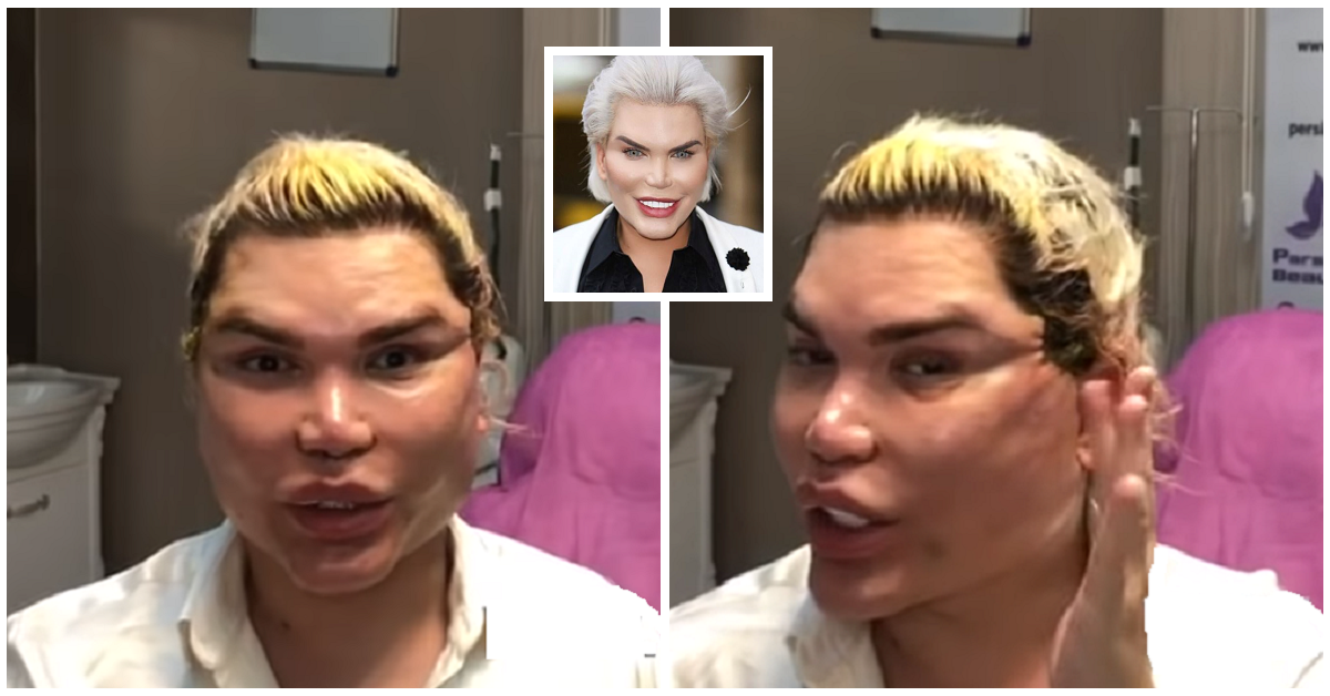 Il nuovo viso di Rodrigo Alves