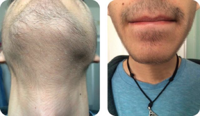 peli-barba