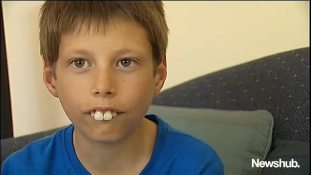 Evan-vittima-di-bullismo-a-causa-della-forma-dei-suoi-denti