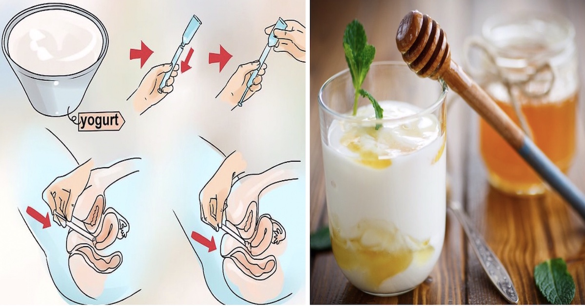 Yogurt nelle parti intime per curare le infezioni da lievito