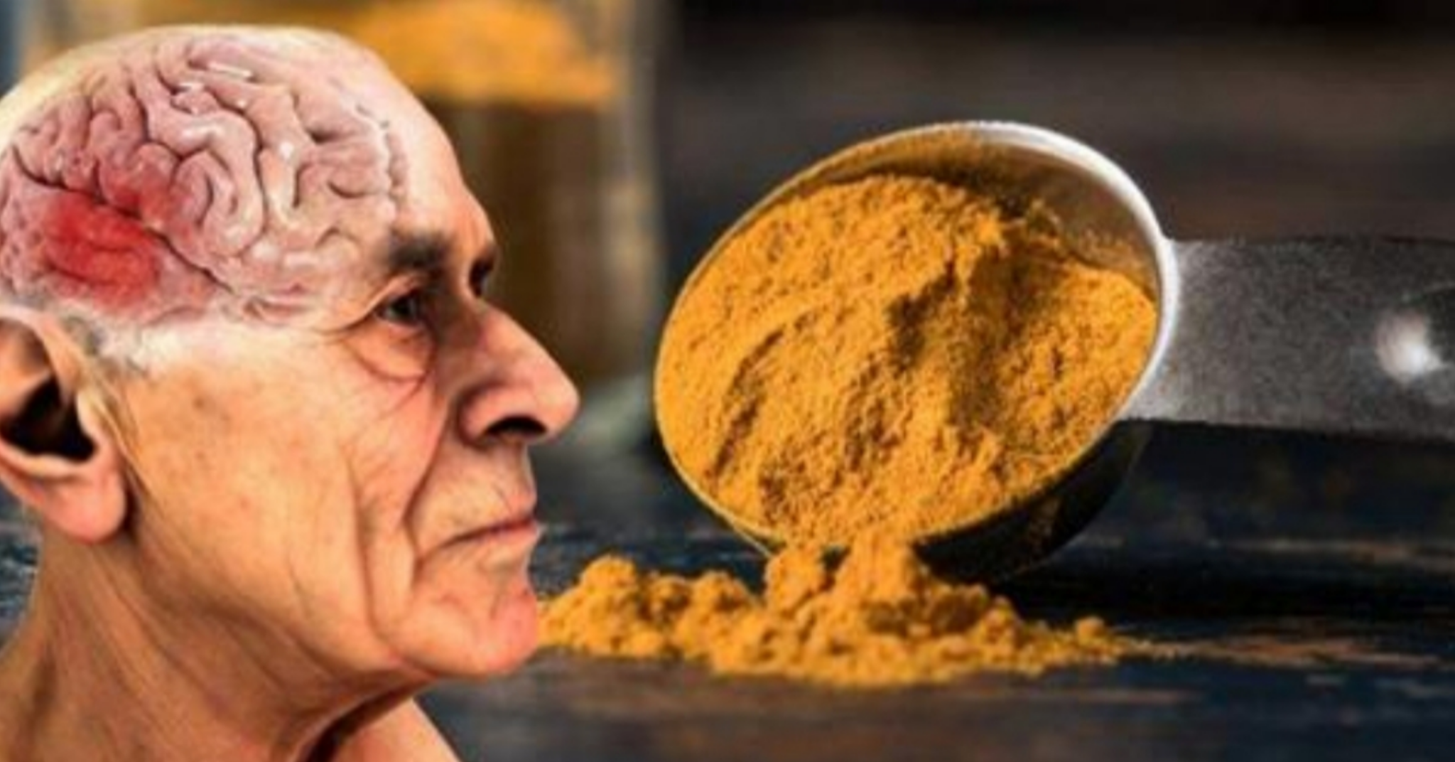 La curcuma aiuta i malati di Alzheimer