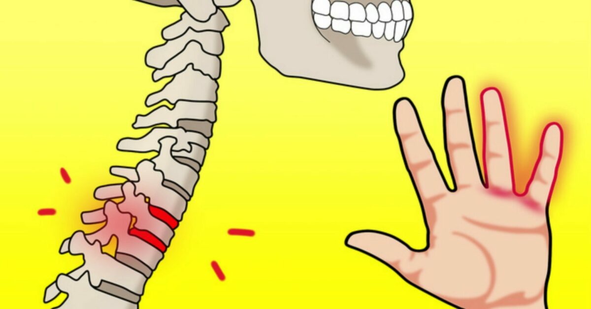Le 8 cause dell’intorpidimento delle mani