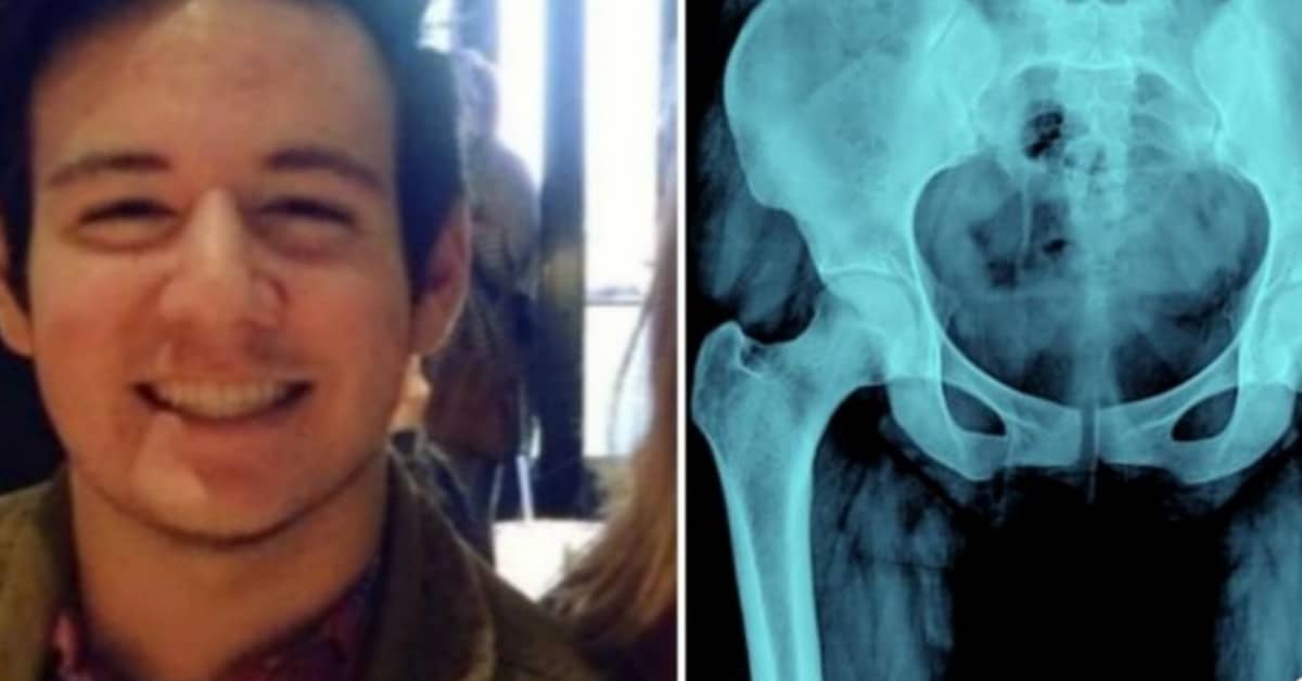 La realtà su quello che è accaduto a Josh