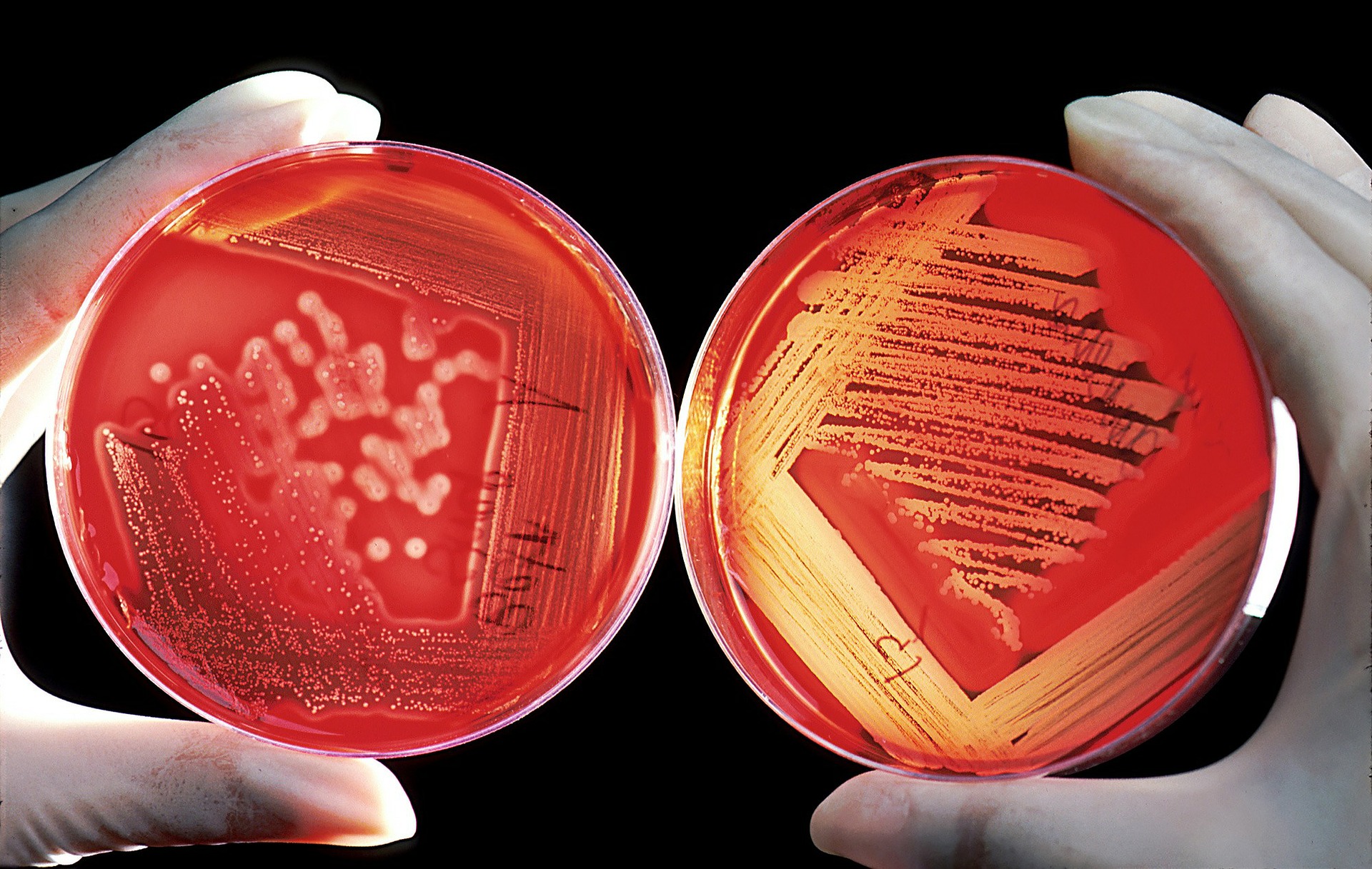 Candida auris, un fungo letale che può uccidere in tre mesi