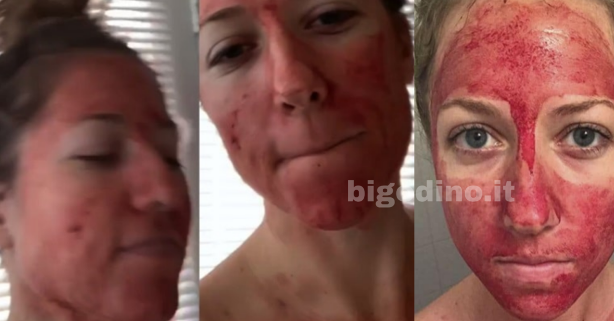 Influencer si cosparge il volto con il sangue mestruale