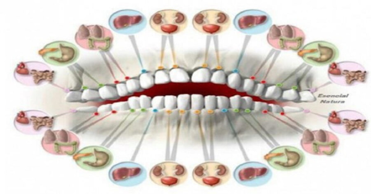 Ogni dente è associato a una parte del corpo. E lo è anche il dolore