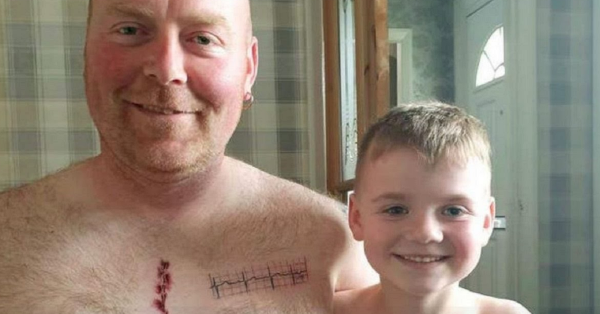 Papà si tatua sul petto la stessa cicatrice del figlio