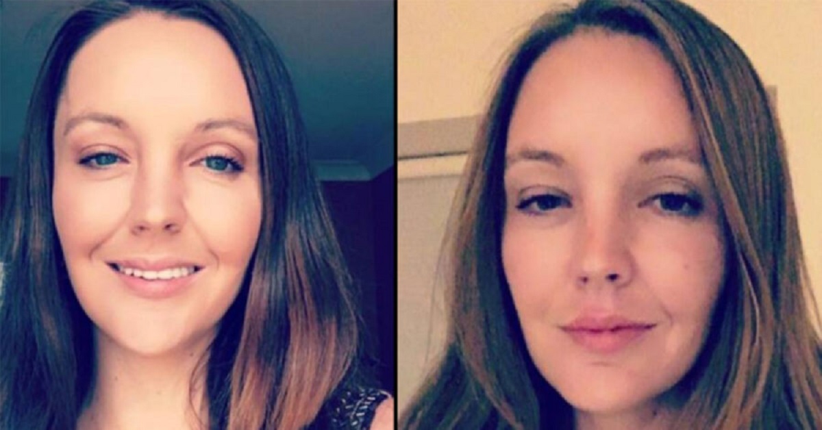 Non mettete i piedi sul cruscotto: donna rimane senza fronte dopo un incidente