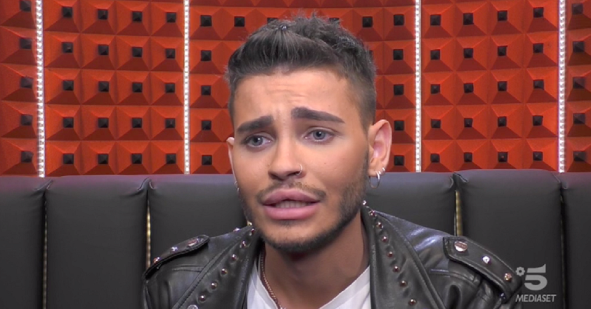 Cristian Imparato si è rifatto gli zigomi ed è irriconoscibile