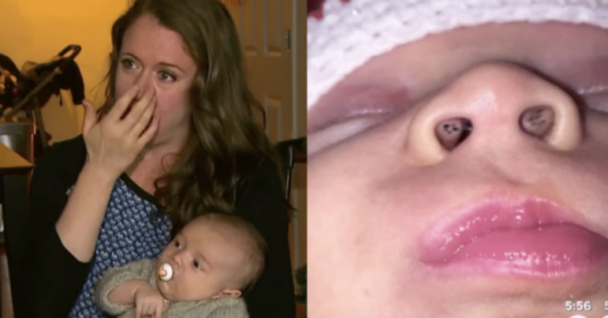 Madre nota dei granelli neri nel naso del suo bambino