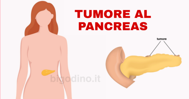 tumore al pancreas