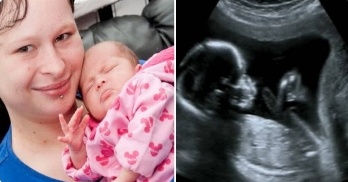 I medici informano Holly che il bambino dentro di se è morto, ma lei sente che non è così