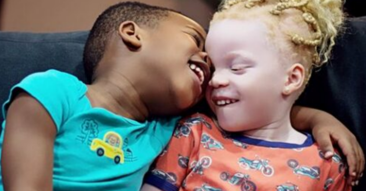 Mamma da alla luce due gemelli diversi. Adesso sta insegnando loro ad abbracciare le differenze.
