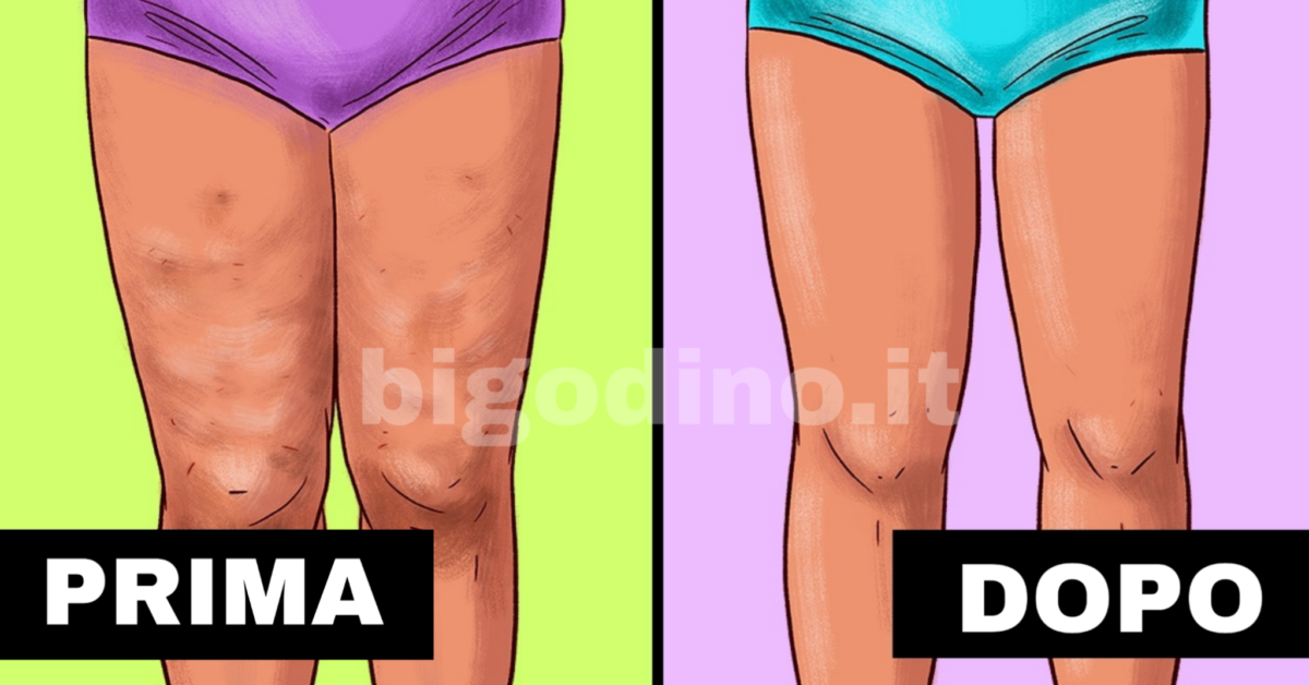 Alimenti che combattono la cellulite