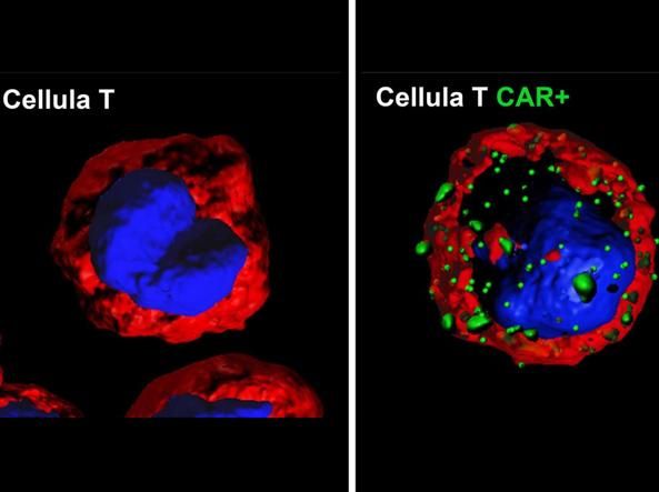 terapia-car-t