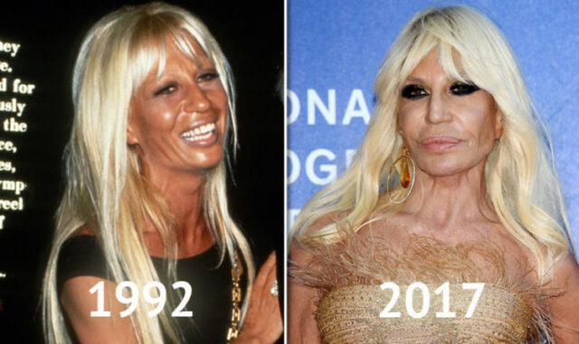 donatella-versace-prima-e-dopo