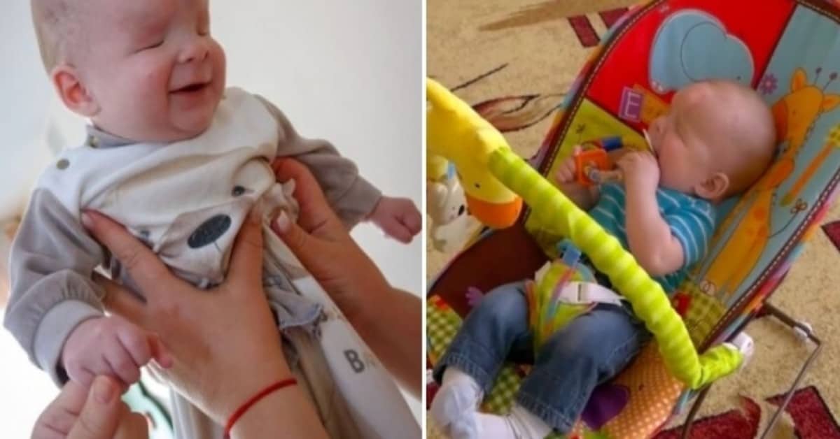 La storia di Alexander K, il bambino nato senza i bulbi oculari