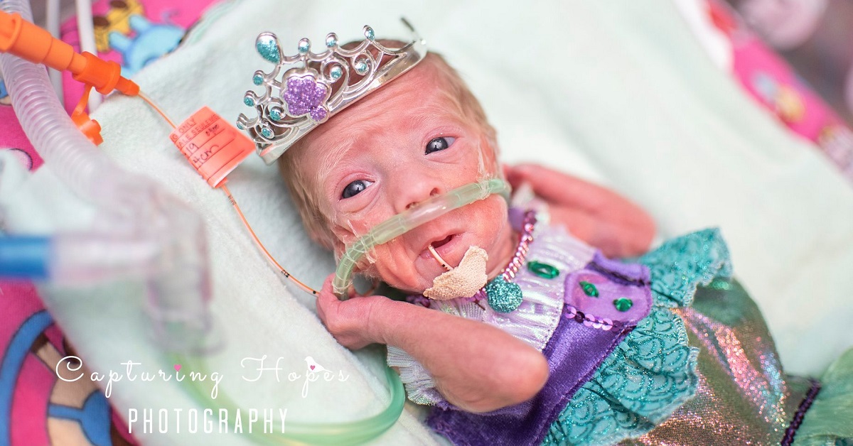 I bambini prematuri festeggiano Hallowen nel reparto terapia intensiva neonatale