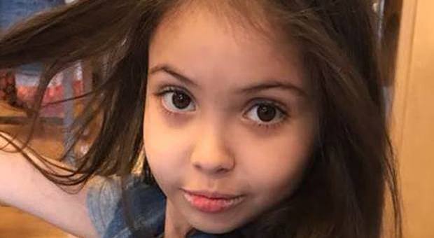 Giorgia, affetta dalla sindrome di Berdon: operata