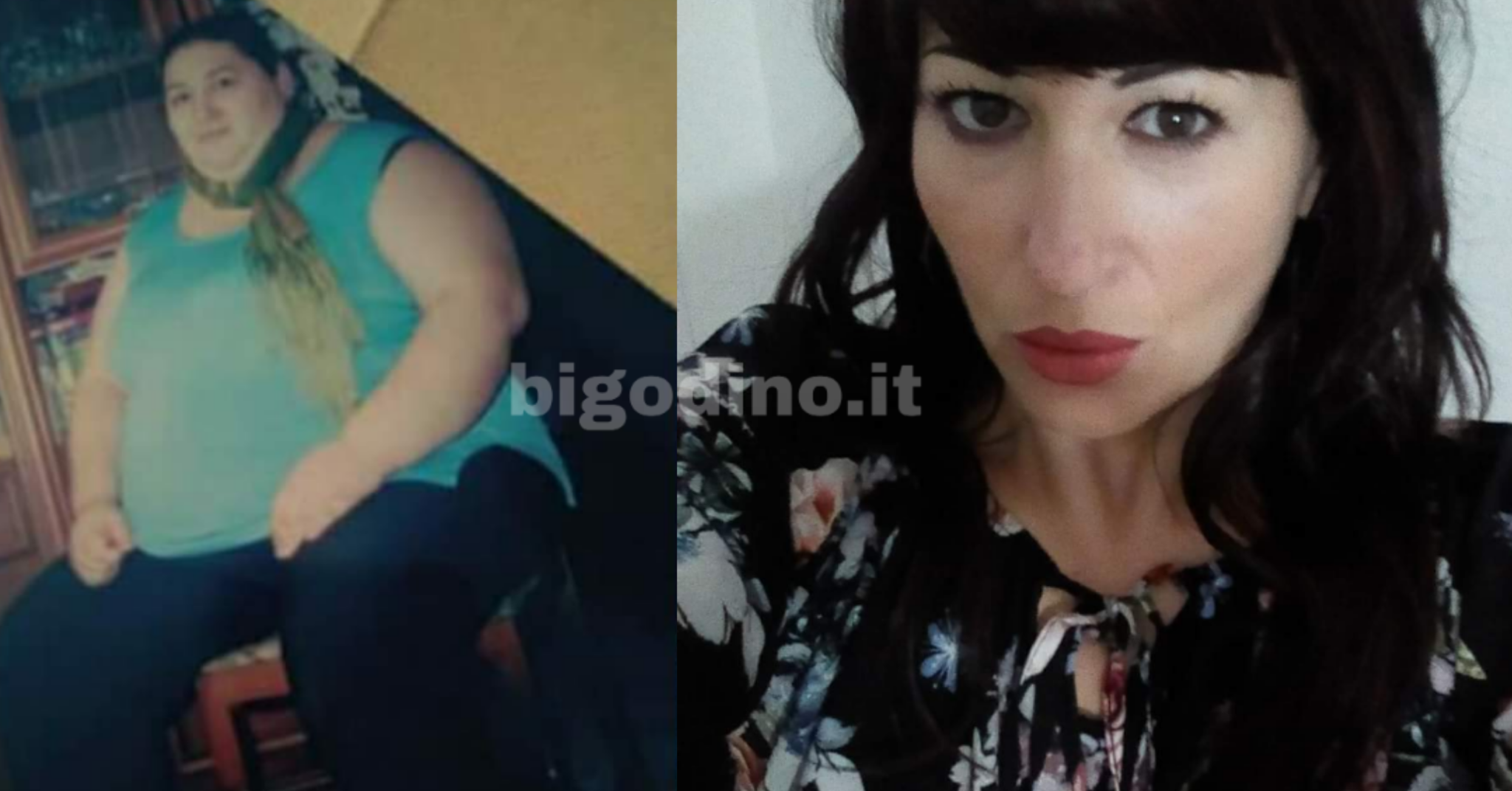 Pesava 220 kg per una sindrome ormonale, ora ne ha persi 140
