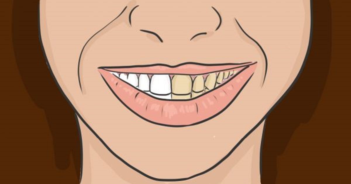 Come sbiancare i denti con prodotti naturali