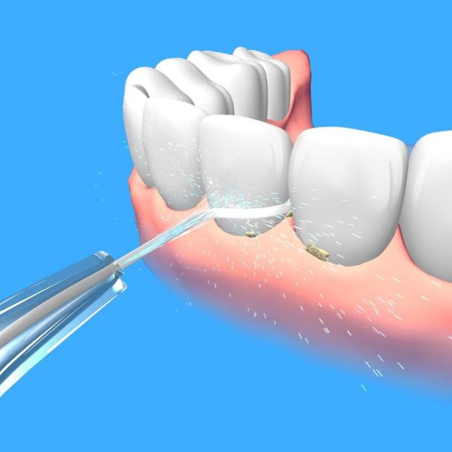 denti