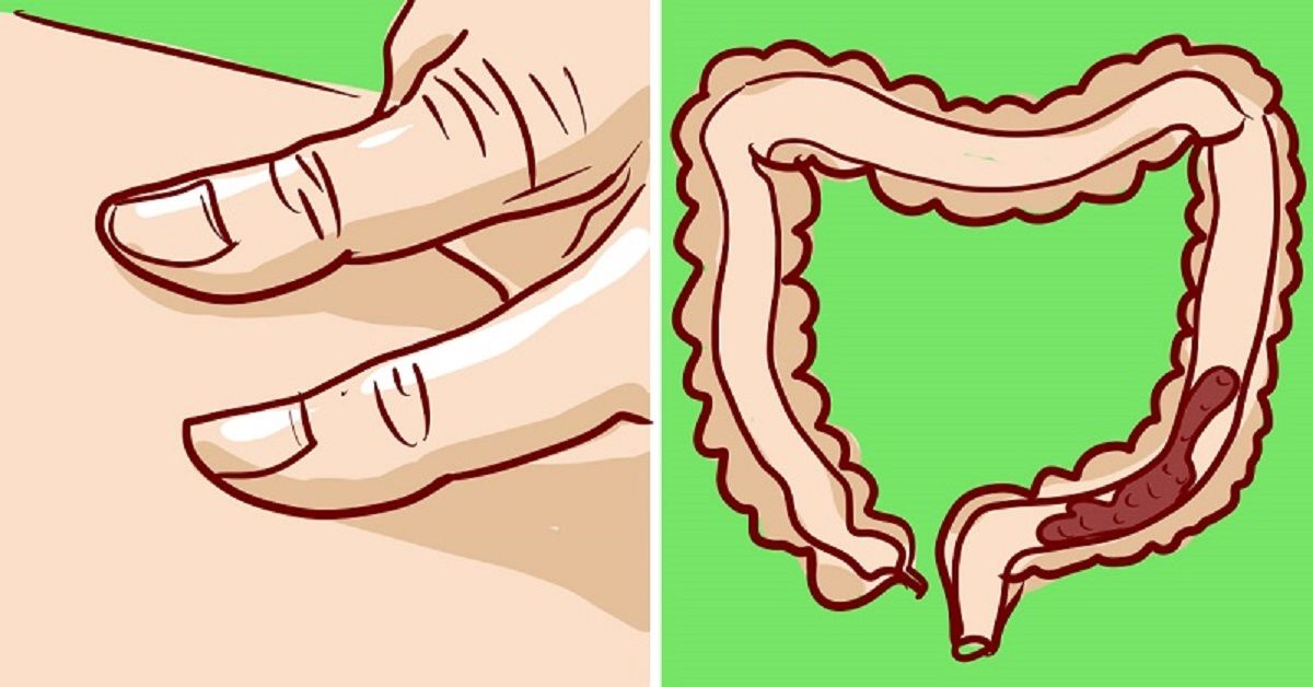 intestino-mano