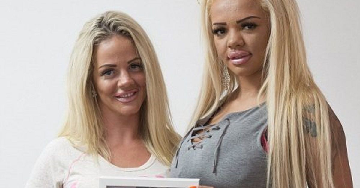 Madre e figlia spendono 86mila dollari per assomigliare alla loro modella preferita