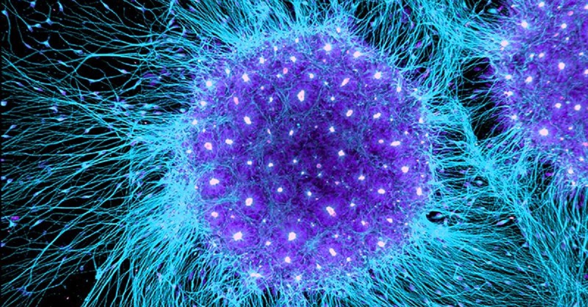 Cancro, la cellula T che potrebbe sterminare molti tipi di tumore