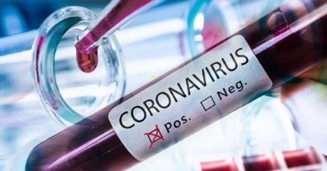 Coronavirus-medico-positivo-al-test-ha-fatto-3-turni-allospedale-di-Treviso-e-in-isolamento
