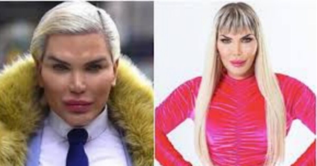 Rodrigo Alves ora è Jessica. Ecco quanto ha speso in interventi estetici. Cifra da capogiro