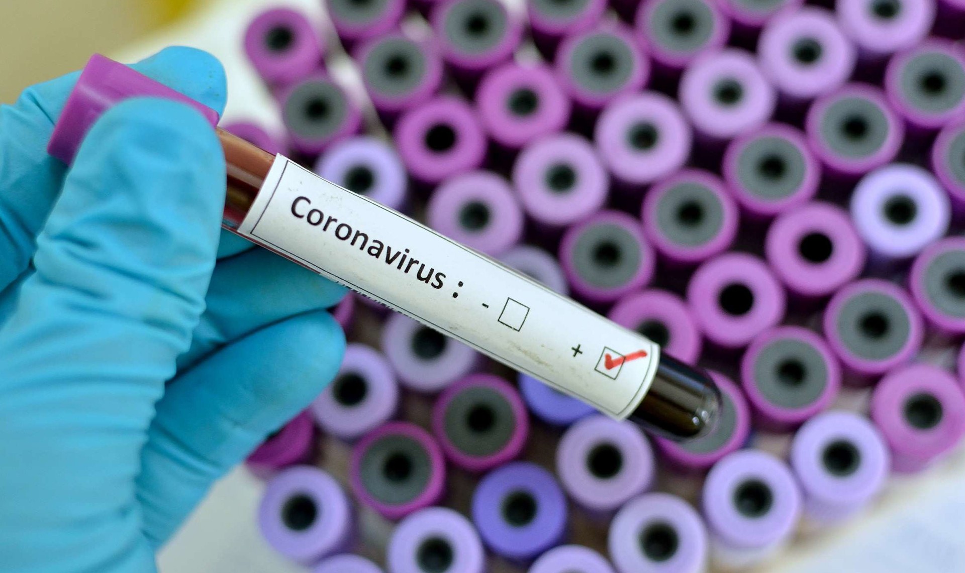 coronavirus