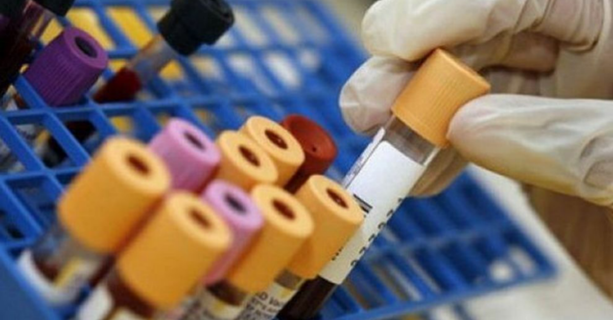 Un test del sangue può rilevare il cancro prima che si manifesti