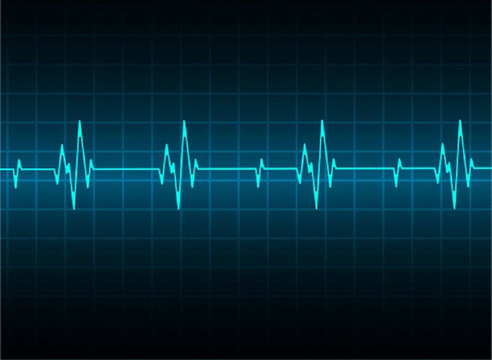 monitor-battiti-cardiaci