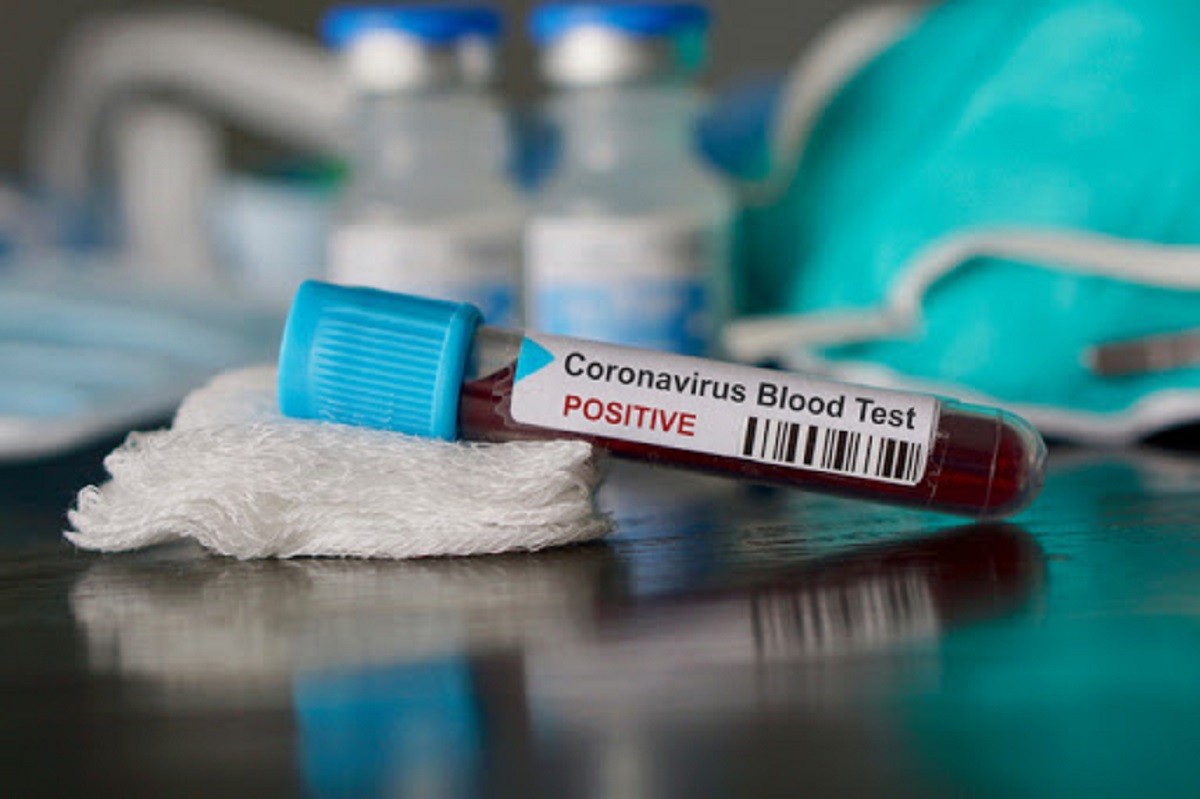test-coronavirus