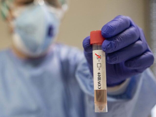 Coronavirus-ragazzo-di-23-anni-ricoverato-in-rianimazione 1
