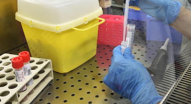 Coronavirus-Andrea-Tesei-ha-perso-la-vita 1