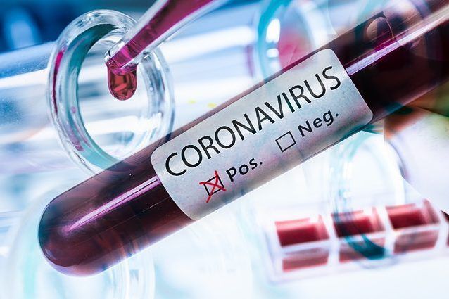 Coronavirus-bimbo-di-5-mesi-positivo-al-test