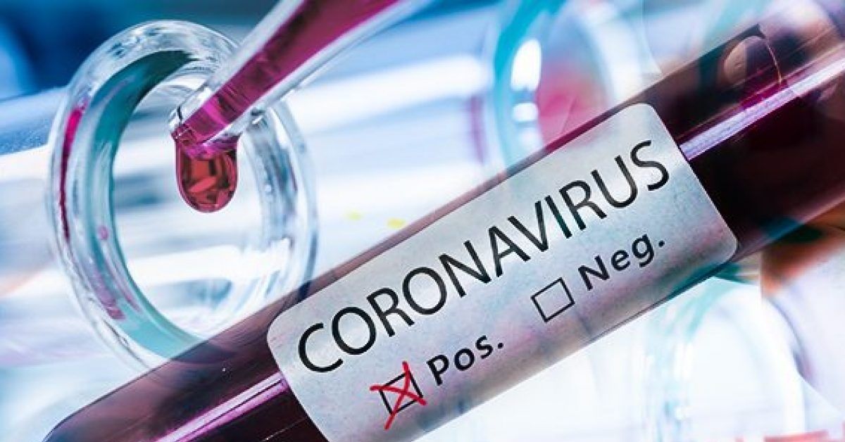 Coronavirus-6-medici-del-Policlinico-Umberto-I-positivi-al-test-in-isolamento-nelle-loro-abitazioni
