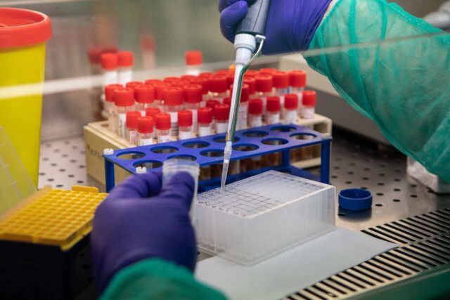 Coronavirus-6-medici-del-Policlinico-Umberto-I-positivi-al-test 1
