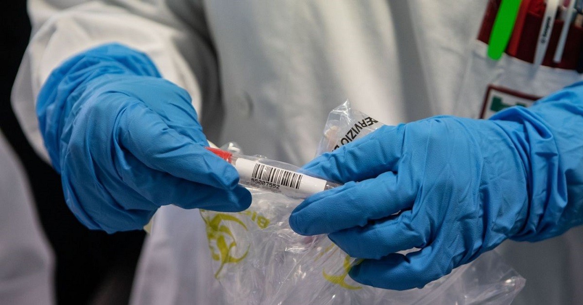 Coronavirus, donna positiva parte da Pavia fino a Modica